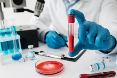 best pathology lab in Purnia, best lab for blood test in purnia, best nabl lab in purnia
